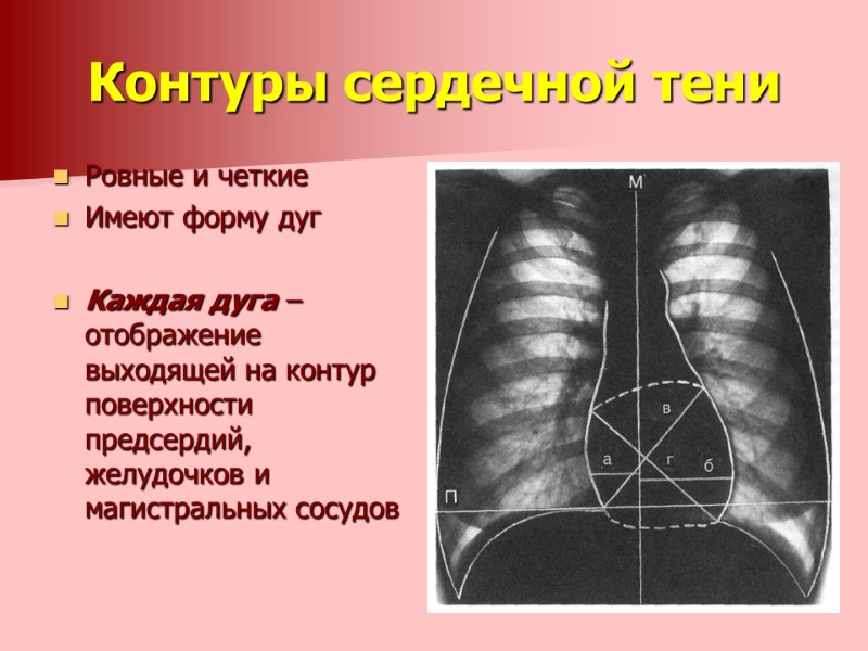 Контуры сердечной тени Ровные и четкие Имеют форму дуг  Каждая дуга – отображение